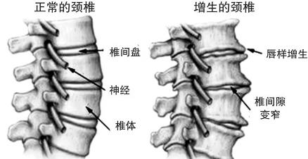 中醫(yī)帶你走進(jìn)頸椎病.jpg