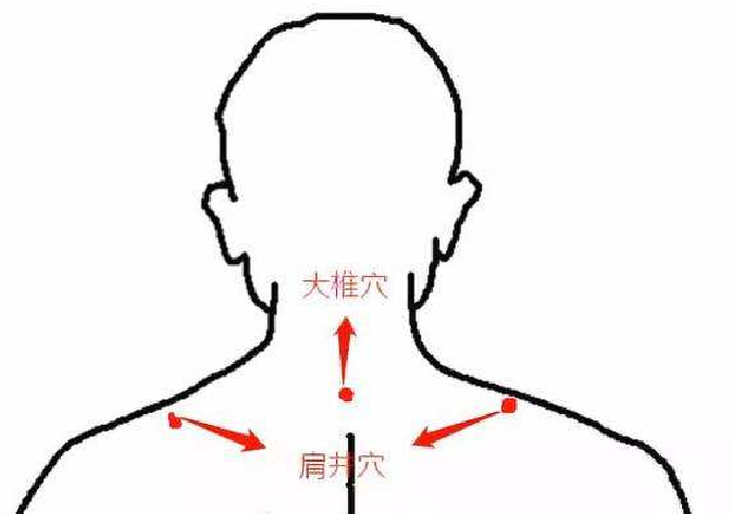 按肩井穴對頸椎病有效嗎