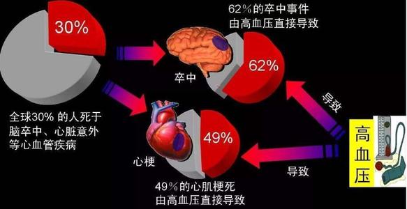 繼發(fā)性高血壓，比原發(fā)性高血壓更加危險(xiǎn)